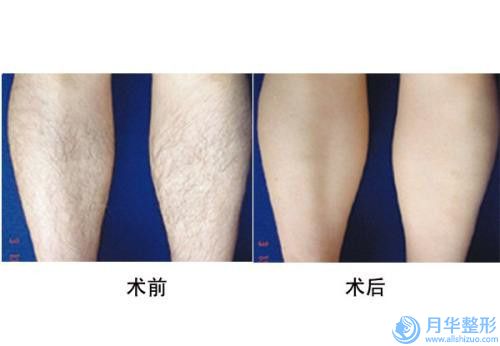 六安市面部超聲刀何時(shí)出醫(yī)生口碑榜好評(píng)多-六安市面部超聲刀何時(shí)出醫(yī)生