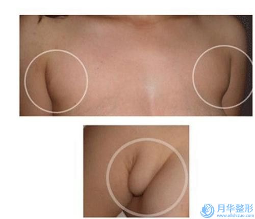溫州市豐額術醫(yī)生口碑排行前十哪個比較好-柯友輝醫(yī)生專業(yè)有保障