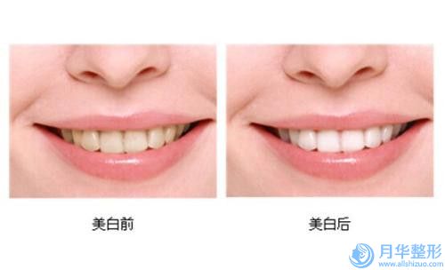 包頭市超聲吸脂醫(yī)生排名榜十強(qiáng)精準(zhǔn)貼-常建民醫(yī)生口碑絕了_推薦收藏