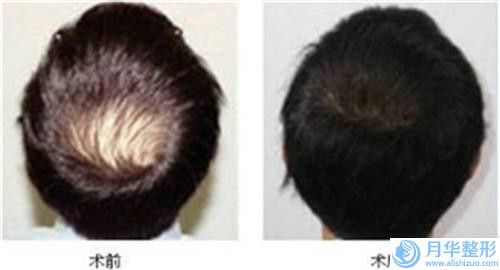 南昌市面部除皺針除皺紋醫(yī)院在榜清單前十名權(quán)威分析（南昌名麗醫(yī)療美容大咖實力詳解）