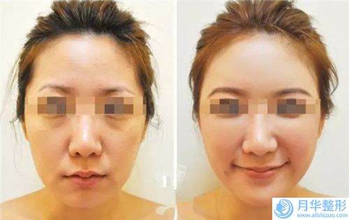 陽江市水晶漂唇醫(yī)院排名榜十強(qiáng)合集公布-排名靠前陽江市整形醫(yī)院