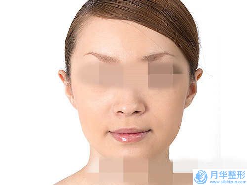 宜昌市豐下巴整形醫(yī)生口碑排行名單揭秘-常海龍醫(yī)生廣受好評