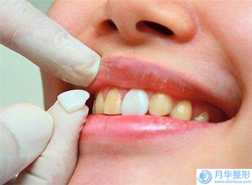 先天性肥胖減肥整形術(shù)有后遺癥嗎「先天性肥胖減肥術(shù)會(huì)有后遺癥嗎」