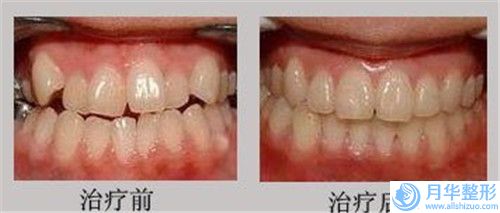 連云港市自體脂肪豐手醫(yī)生口碑榜前十都是哪個-王來奎醫(yī)生價格標準重點看