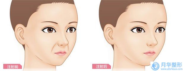 洛陽快速祛斑整形的價(jià)格受到哪些因素的影響