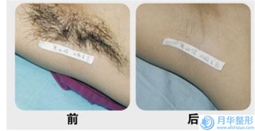 上海市激光除痘疤醫(yī)生排行前十佳全面pk-劉宇醫(yī)生前四口碑優(yōu)異