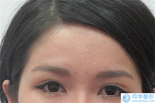 重慶市兔唇修復(fù)二期醫(yī)生排名榜前十強評選發(fā)布-葉元洪醫(yī)生價格標(biāo)準(zhǔn)更新