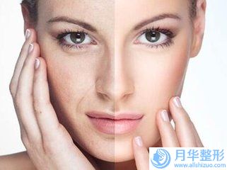 激光點斑后有什么不良后果(激光點斑手術后遺癥是什么)