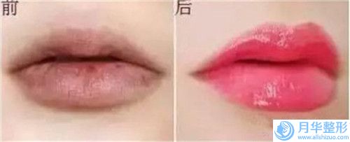 滄州市做瘦下巴醫(yī)院綜合實(shí)力前十佳口碑排行干將推薦-滄州紅提醫(yī)療美容診所認(rèn)證
