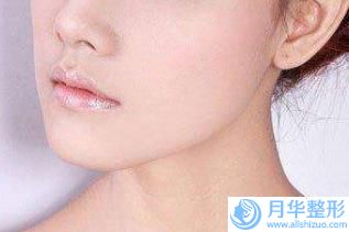 沈陽玻尿酸墊下巴圖手術(shù)費(fèi)用多少呢_沈陽玻尿酸墊下巴圖的價(jià)格一般是多少錢