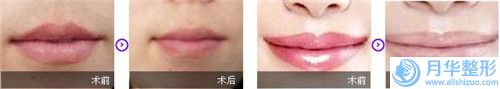 眉山市歐菲隆下巴醫(yī)院排名前十強(qiáng)嚴(yán)選推薦（眉山市歐菲隆下巴整形醫(yī)院）