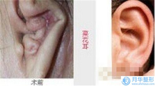 海南省乳房豐胸醫(yī)生排名前十強(qiáng)哪個(gè)醫(yī)-許新軍醫(yī)生名至實(shí)歸位列非常好