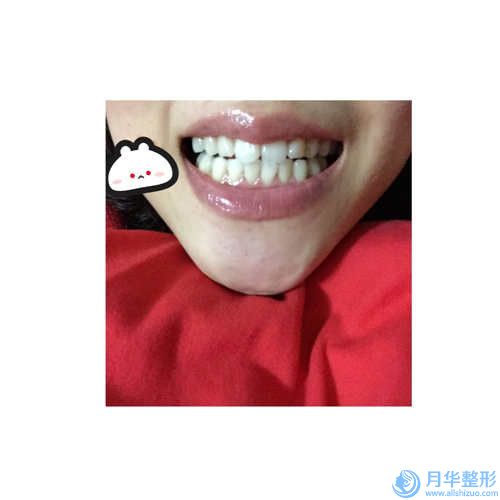 陽泉市腹腰部分吸脂價格表2023全新出爐-陽泉市腹腰部分吸脂價格行情