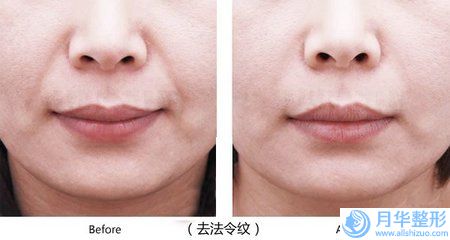 去色斑整形的價(jià)格怎么樣(去色斑的費(fèi)用要多少錢呢)