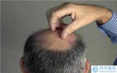 貴州省亞韓瘦臉針醫(yī)生排名榜top10匯總測(cè)評(píng)-魯加祥醫(yī)生助力變美