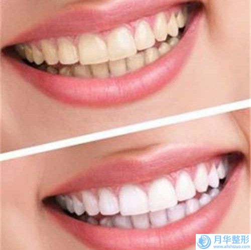營口市電子吸脂減肥醫(yī)院排行榜加加加-營口康藝美容整形中心榜一無爭議