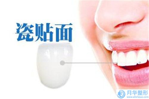 腰部吸脂會留什么后遺癥呢(腰部吸脂術四大后遺癥)
