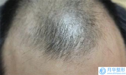 甘肅省改臉型臉部整形手術(shù)醫(yī)生口碑排行前十佳醫(yī)美醫(yī)生匯總-甘肅省單寶奇整形醫(yī)生