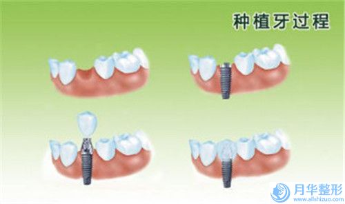 通遼市做腹壁吸脂整形醫(yī)院綜合實(shí)力十強(qiáng)排名榜醫(yī)美機(jī)構(gòu)點(diǎn)評(通遼賽美瑞醫(yī)療美容門診盤點(diǎn)實(shí)力專家)