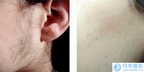 趙庚如整形醫(yī)生-銀川悅?cè)f佳醫(yī)療美容診所趙庚如醫(yī)生面部玻尿酸祛斑口碑top人氣匯總