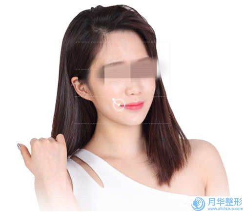 益陽(yáng)市溶脂針打下巴醫(yī)院排行榜揭曉口碑紅榜推薦-排名靠前益陽(yáng)市整形醫(yī)院