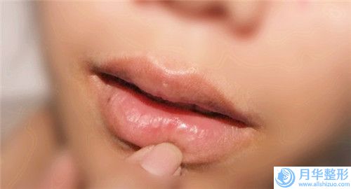 江門市臉上打溶脂針整形外科價格表(費用標(biāo)準(zhǔn))2023-江門市臉上打溶脂針價格行情