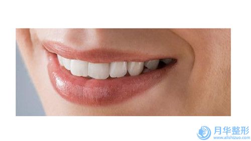 眶隔脂肪釋放術(shù)術(shù)的效果如何呢-眶隔脂肪釋放術(shù)效果到底有多好