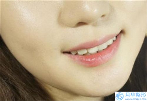 清遠(yuǎn)臀部減肥手術(shù)的價(jià)格是多少效果如何