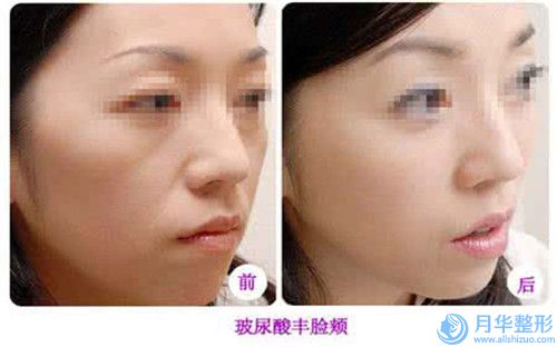 徐州市唇缺損修復(fù)術(shù)醫(yī)生排行top10強(qiáng)顯示一覽-李亞飛醫(yī)生等技術(shù)強(qiáng)中強(qiáng)