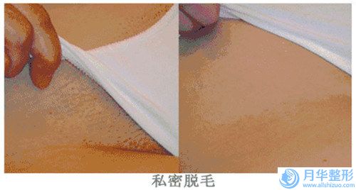 惠州廋臉針術(shù)的價(jià)格是多少(惠州廋臉針手術(shù)價(jià)格要多少呢)