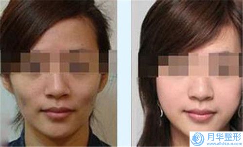 2023年宜昌市成人兔唇修復(fù)醫(yī)院上榜清單top10口碑榜發(fā)布(宜昌市成人兔唇修復(fù)整形醫(yī)院)