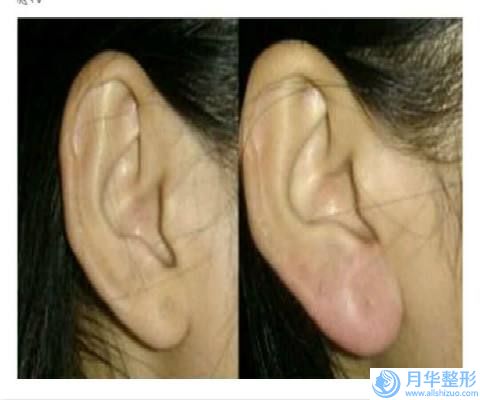 梅州市胸部下垂整型手術(shù)醫(yī)院口碑排行前十名私立醫(yī)美匯總-排名靠前梅州市整形醫(yī)院
