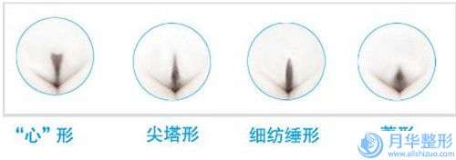 佛山填充下臉部整形需要花費費用多不多