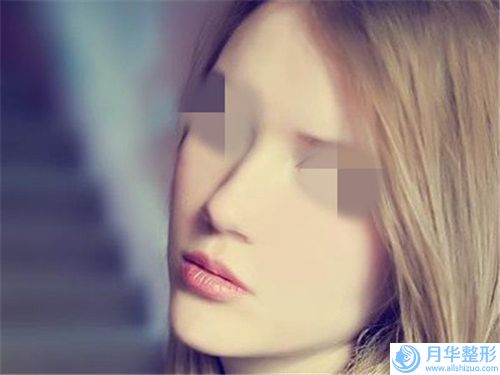 肉毒素去除鼻背紋整形手術(shù)效果好嗎「肉毒素去除鼻背紋的效果好不好 安全嗎」