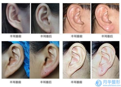 齊齊哈爾市乳房矯正醫(yī)院排行前十名強大匯總（齊齊哈爾市乳房矯正整形醫(yī)院）