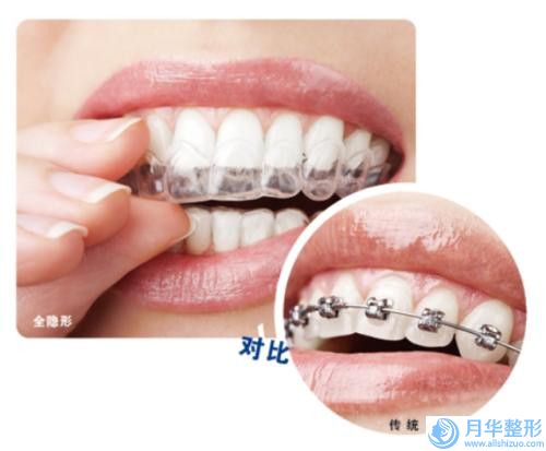 泰安市女人吸脂價格表費用說明(近6個月均價為：20022元)