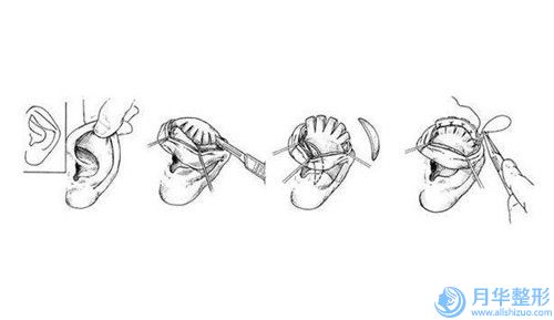 淮南市乳腺再造整形科價(jià)目表(費(fèi)用標(biāo)準(zhǔn))內(nèi)部流傳版公示-淮南市乳腺再造均價(jià)為36558元