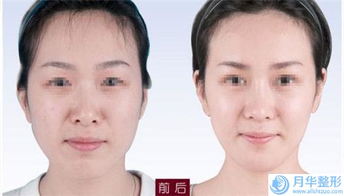 南京秦淮六博醫(yī)療美容門診部珍貴一手價(jià)格表曝光-南京秦淮六博醫(yī)療美容門診部輕度唇裂能完全修復(fù)到底需要多少錢