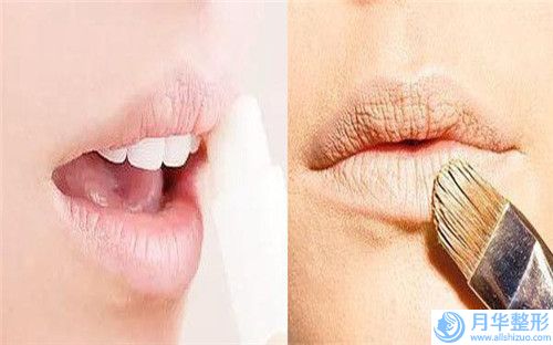 新鄉(xiāng)市歐菲隆下巴價格表新版更新公布-新鄉(xiāng)市歐菲隆下巴價錢需要多少