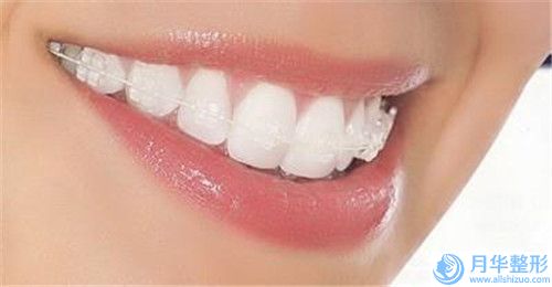 下巴水吸脂術(shù)后需要做哪些相關(guān)的護(hù)理