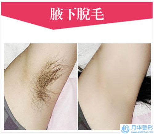 玻尿酸膠原蛋白豐臉頰效果不佳為什么