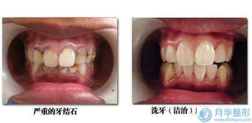 玉林市射頻溶脂瘦后背術(shù)醫(yī)院在榜清單top10強(qiáng)很不錯(cuò)-玉林市皮膚病防治站美容科價(jià)格童叟無欺