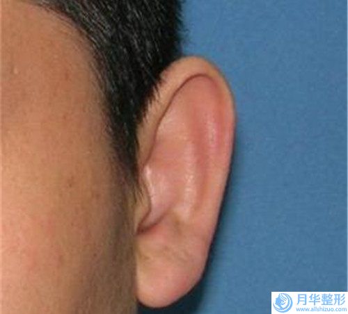 隆胸修復(fù)后幾天能見效,隆胸修復(fù)效果不理想該怎么辦