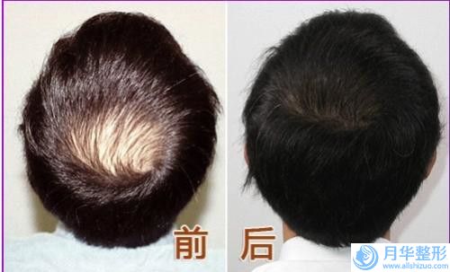 廣元市面部水動力吸脂瘦臉醫(yī)院榜單TOP10強名單整理好了（廣元市面部水動力吸脂瘦臉整形醫(yī)院）