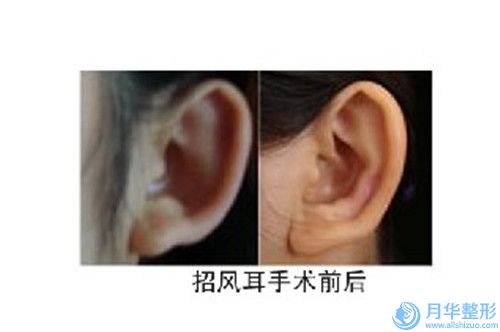 2023年湘潭市乳房切除再造術醫(yī)院上榜清單前十名較新安利(湘潭市中心醫(yī)院整形科口碑價目表出爐)