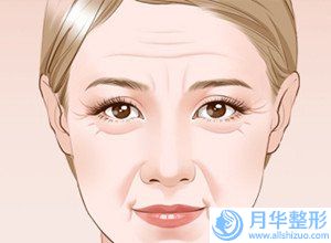 北京美白淡斑祛痘的手術(shù)費(fèi)用一般是多少