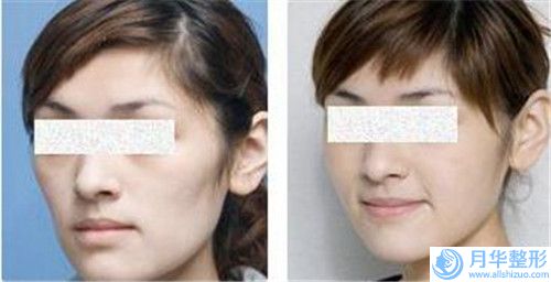 楊承革整形醫(yī)生彩光脫毛去唇毛值得收藏的優(yōu)質(zhì)醫(yī)生榜單-大連許英醫(yī)療美容