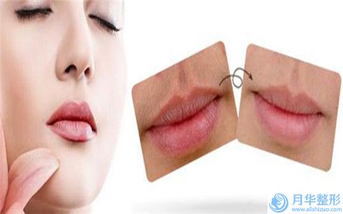 儀哲哲整形醫(yī)生肉毒素去瘦臉去過(guò)的人都來(lái)推薦-杭州麗本醫(yī)療美容