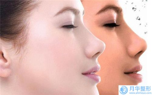 做去色斑術(shù)如何保持效果呢-做去色斑整形手術(shù)效果對(duì)比