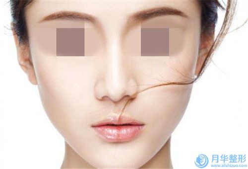 生長隆鼻后多久有效果,生長隆鼻術(shù)能保持多久效果